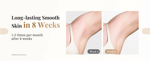 999900 Flashes 3-in-1 Laser Epilator Painless IPL Hair Removal for Women Bikini Legs Arms Laser Hair Remover Permanent Depilato