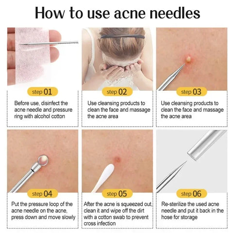 11Pcs Acne Needle Professional Tweezers Acne Remover Ultra-fine No. 5 Cell Pimples Blackhead Clip Facial Pore Cleaning Care Tool