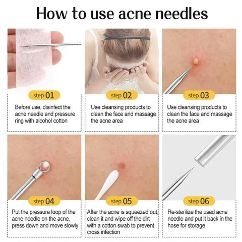 11Pcs Acne Needle Professional Tweezers Acne Remover Ultra-fine No. 5 Cell Pimples Blackhead Clip Facial Pore Cleaning Care Tool