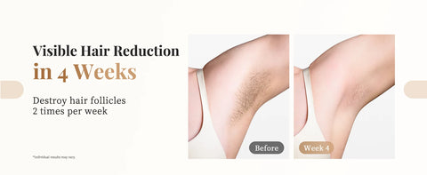 999900 Flashes 3-in-1 Laser Epilator Painless IPL Hair Removal for Women Bikini Legs Arms Laser Hair Remover Permanent Depilato