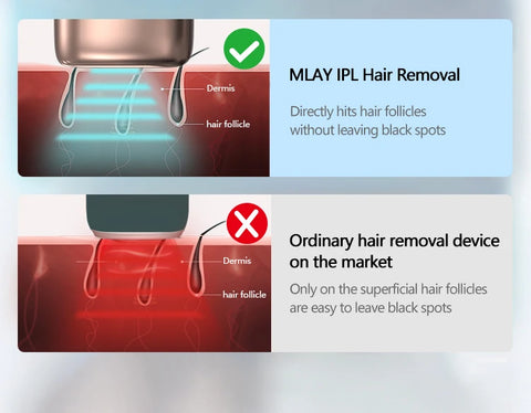 MLAY T14 Laser Hair Removal Permanent Malay IPL Epilator Ice Cool Painless Depilador a Laser 500000 Flashes Face Body Epilator