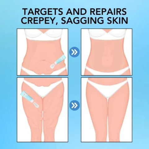 OUHOE Body Firming and Anti - wrinkle Cream - Moisturize, Deeply Nourish, Firm Skin, Whiten & Smooth, Delay Aging
