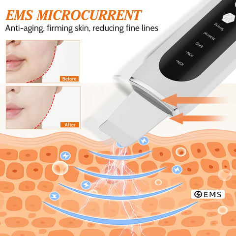 Ultrasonic Facial Shovel Cleanser Skin Scrubber Peeling Blackhead Remover Deep Face Cleaning Ultrasonic Ion Ance Pore Cleaner