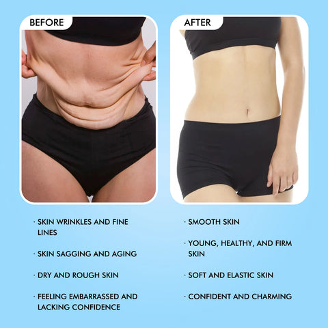 OUHOE Body Firming and Anti - wrinkle Cream - Moisturize, Deeply Nourish, Firm Skin, Whiten & Smooth, Delay Aging