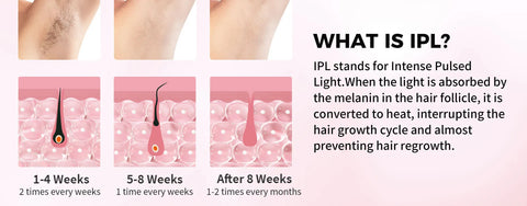 IPL Hair Removal 9 Levels 999900 Flashes MAX 15 J Laser Device Quick Flash 10 Mins for Women Men Whole Body Treament